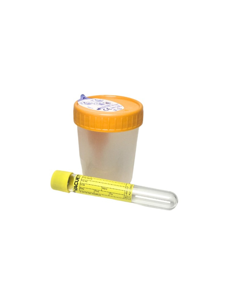 ENVASE ORINA RECOGIDA EN TUBO 25 UNIDADES - UFG